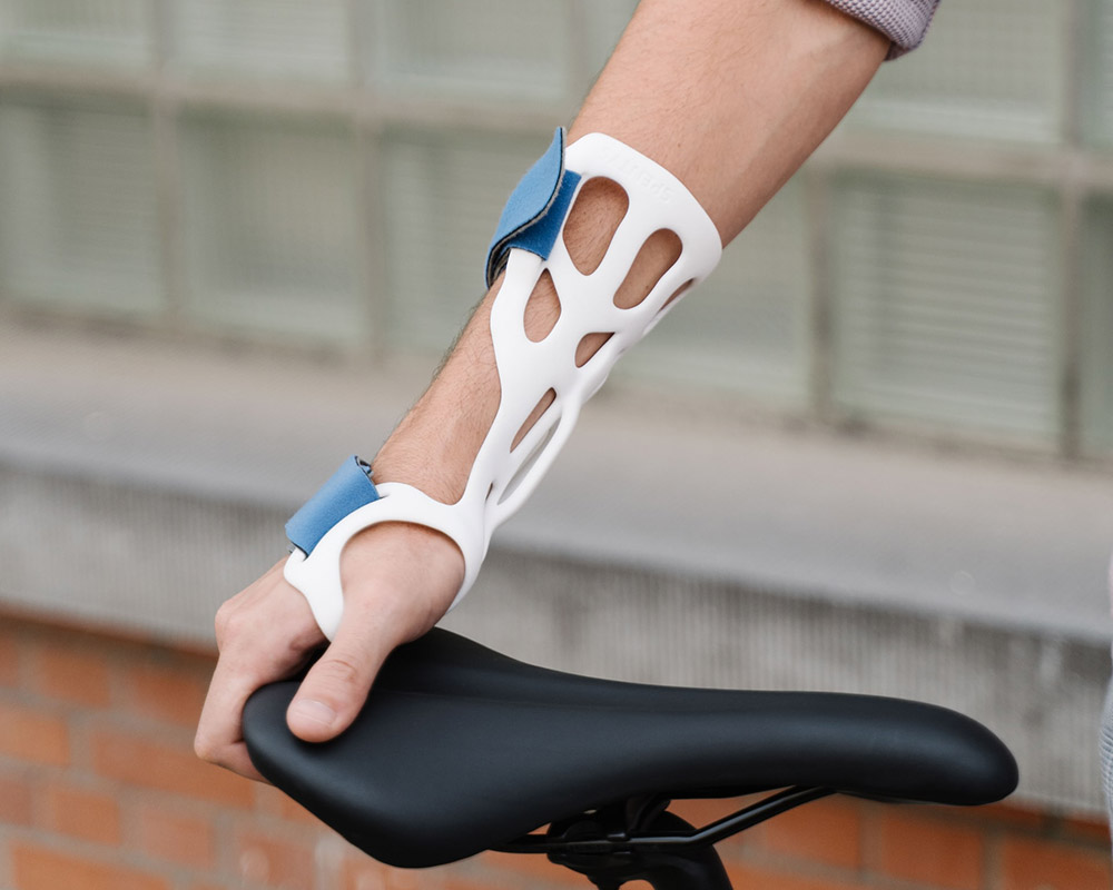 Splint fabrication on a forearm, holding onto a bicycle seat.